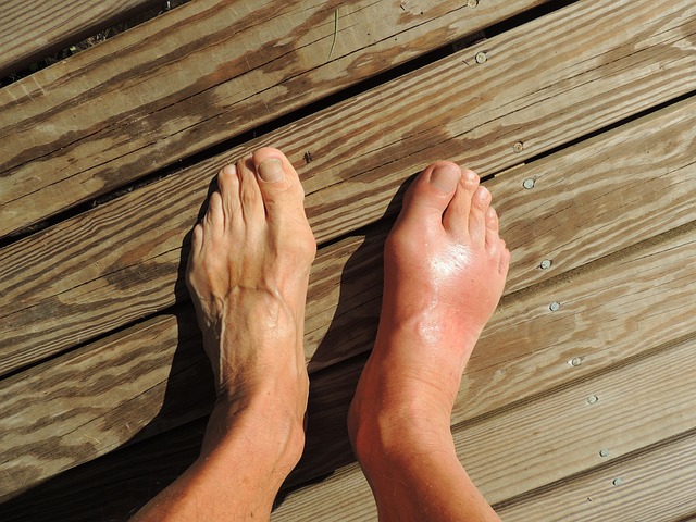 Bolest na chodidle pod prsty: Příčiny a rady pro úlevu